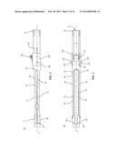 SPINAL IMPLANT SYSTEM AND METHOD diagram and image