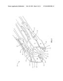 SPINAL IMPLANT SYSTEM AND METHOD diagram and image