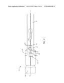 SPINAL IMPLANT SYSTEM AND METHOD diagram and image