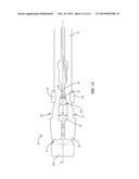 SPINAL IMPLANT SYSTEM AND METHOD diagram and image