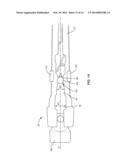 SPINAL IMPLANT SYSTEM AND METHOD diagram and image