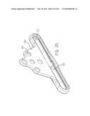 MODULAR OCCIPITAL PLATE diagram and image