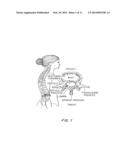 Posterior Spine Attachment Device for Hardware and Paraspinal Musculature diagram and image