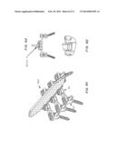 Posterior Spine Attachment Device for Hardware and Paraspinal Musculature diagram and image