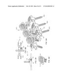 Posterior Spine Attachment Device for Hardware and Paraspinal Musculature diagram and image