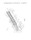 SPINAL IMPLANT SYSTEM AND METHOD diagram and image