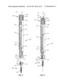 SPINAL IMPLANT SYSTEM AND METHOD diagram and image