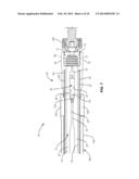 SPINAL IMPLANT SYSTEM AND METHOD diagram and image