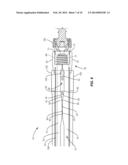 SPINAL IMPLANT SYSTEM AND METHOD diagram and image