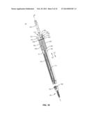 SPINAL IMPLANT SYSTEM AND METHOD diagram and image