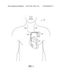 THERAPY DELIVERY ARCHITECTURE FOR IMPLANTABLE MEDICAL DEVICE diagram and image