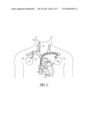 PHYSIOLOGICAL VIBRATION DETECTION IN AN IMPLANTED MEDICAL DEVICE diagram and image