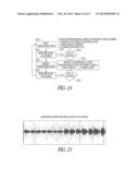 PHYSIOLOGICAL VIBRATION DETECTION IN AN IMPLANTED MEDICAL DEVICE diagram and image