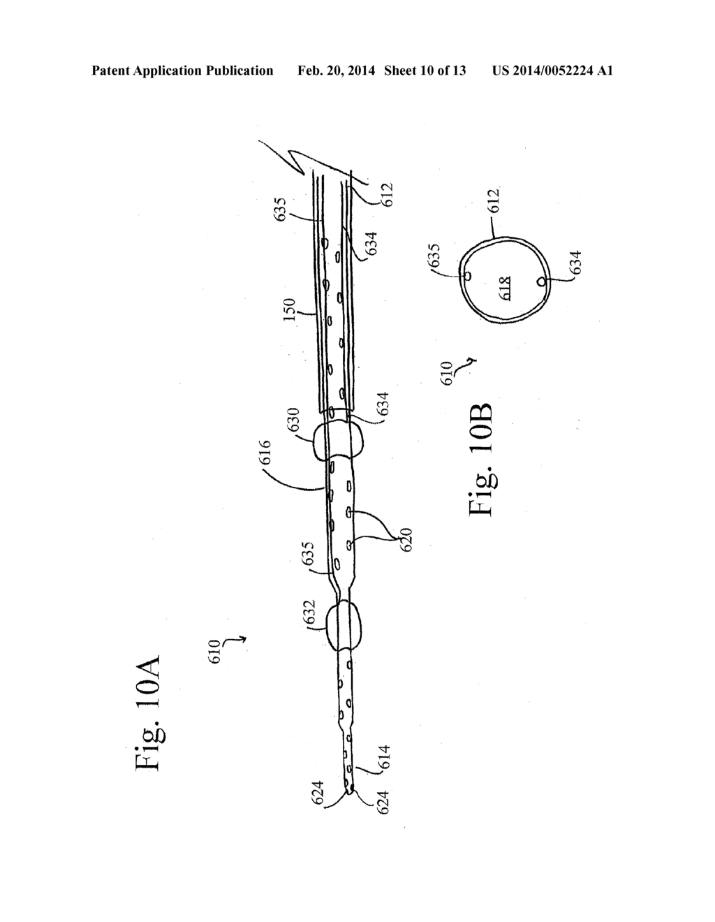 SYSTEMS AND METHODS FOR SELECTIVE AUTO-RETROPERFUSION ALONG WITH REGIONAL     MILD HYPOTHERMIA - diagram, schematic, and image 11