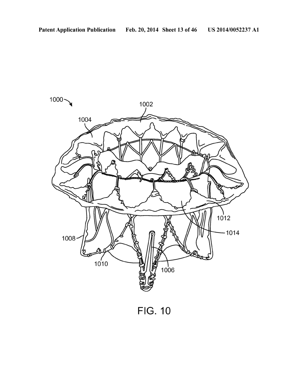 METHODS AND APPARATUS FOR ENGAGING A VALVE PROSTHESIS WITH TISSUE - diagram, schematic, and image 14