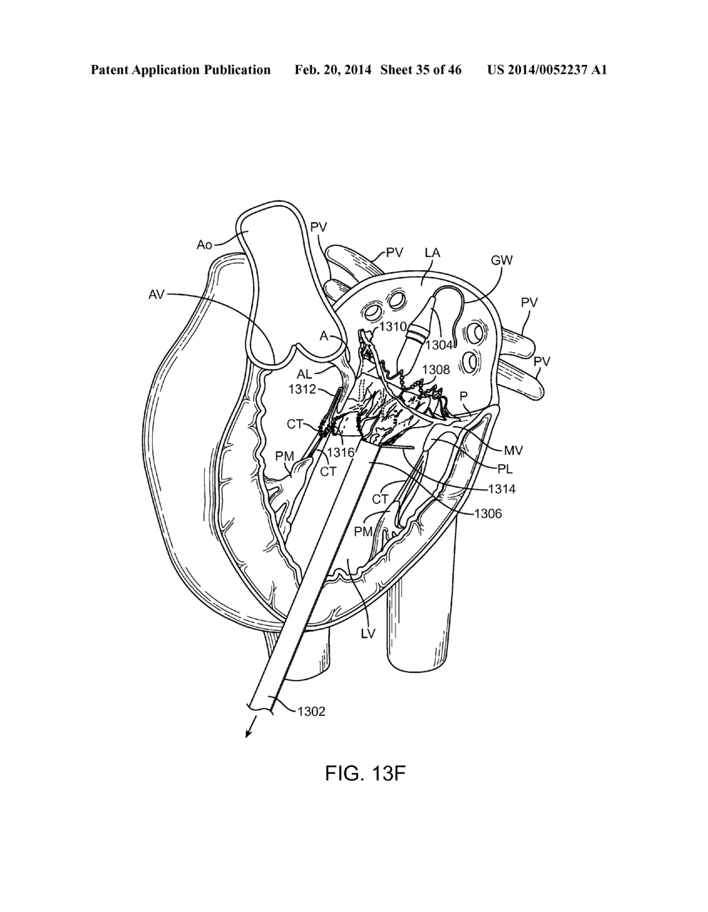 METHODS AND APPARATUS FOR ENGAGING A VALVE PROSTHESIS WITH TISSUE - diagram, schematic, and image 36