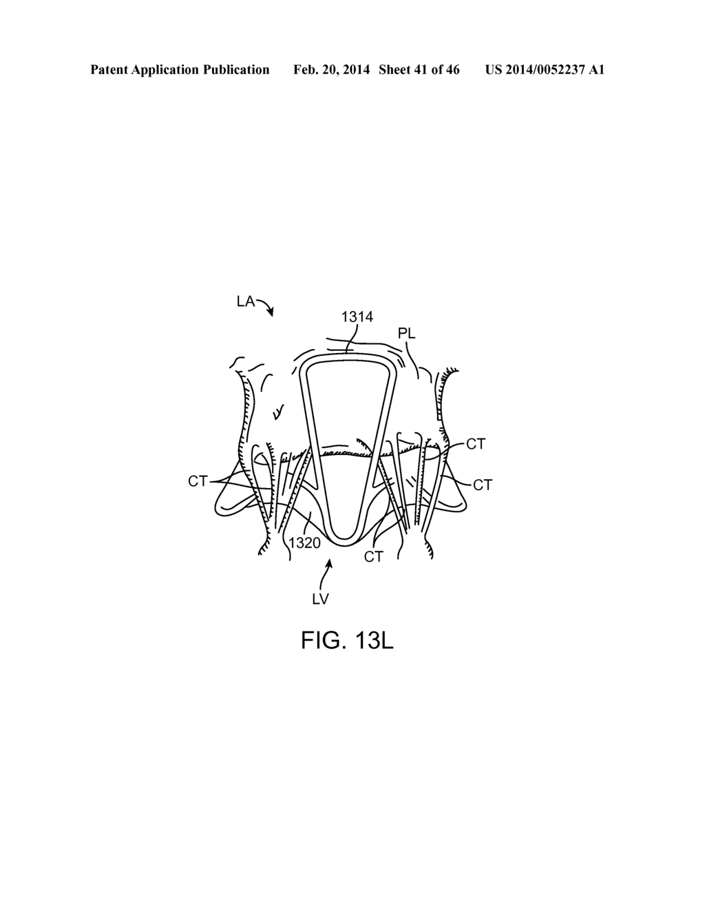 METHODS AND APPARATUS FOR ENGAGING A VALVE PROSTHESIS WITH TISSUE - diagram, schematic, and image 42