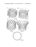 DEVICES AND METHODS FOR DELIVERY OF VALVE PROSTHESES diagram and image