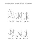 DEVICES AND METHODS FOR DELIVERY OF VALVE PROSTHESES diagram and image