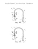 DEVICES AND METHODS FOR DELIVERY OF VALVE PROSTHESES diagram and image