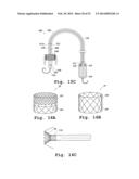 DEVICES AND METHODS FOR DELIVERY OF VALVE PROSTHESES diagram and image