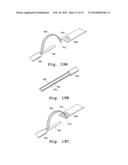 DEVICES AND METHODS FOR DELIVERY OF VALVE PROSTHESES diagram and image