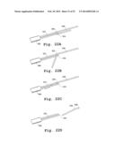 DEVICES AND METHODS FOR DELIVERY OF VALVE PROSTHESES diagram and image