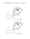 DEVICES AND METHODS FOR DELIVERY OF VALVE PROSTHESES diagram and image