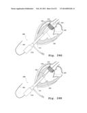 DEVICES AND METHODS FOR DELIVERY OF VALVE PROSTHESES diagram and image