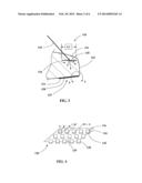 Intraocular Lenses for Managing Glare, Adhesion, and Cell Migration diagram and image