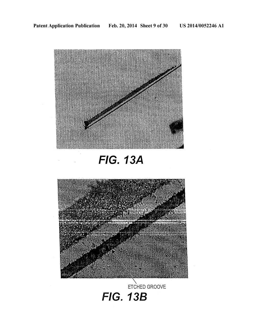 MODULAR INTRAOCULAR LENS DESIGNS AND METHODS - diagram, schematic, and image 10