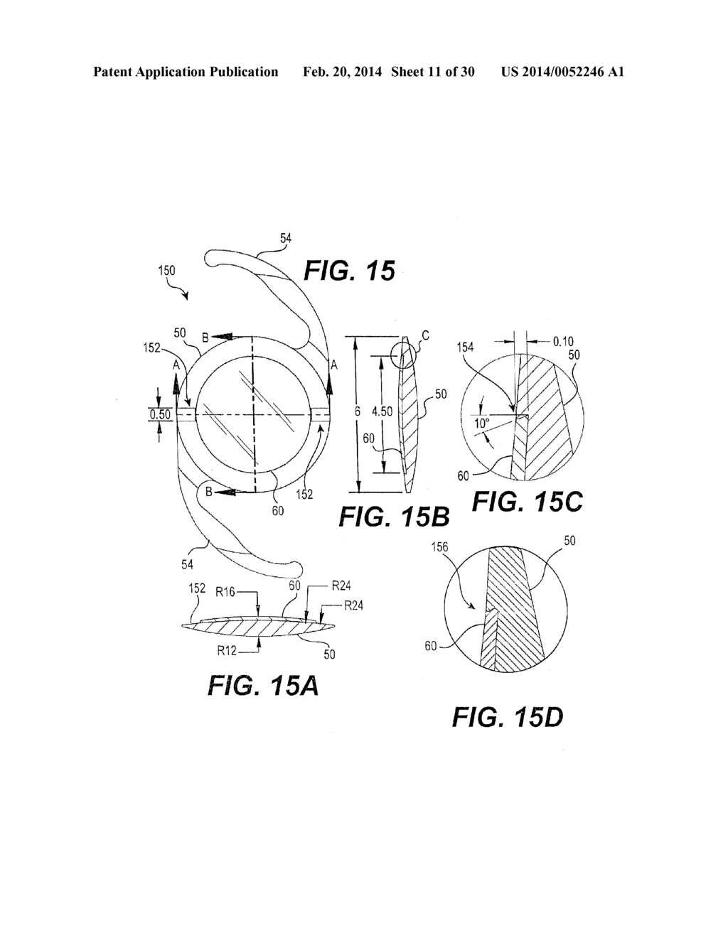 MODULAR INTRAOCULAR LENS DESIGNS AND METHODS - diagram, schematic, and image 12