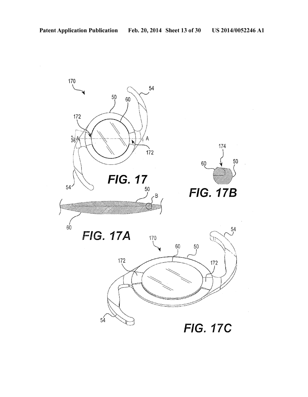 MODULAR INTRAOCULAR LENS DESIGNS AND METHODS - diagram, schematic, and image 14