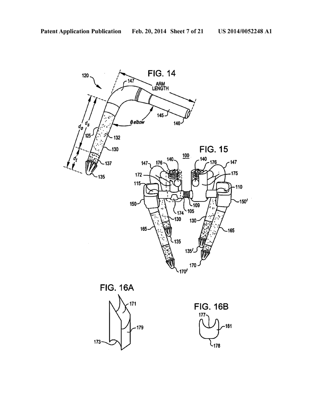 Crossbar Spinal Prosthesis Having a Modular Design and Related     Implantation Methods - diagram, schematic, and image 08