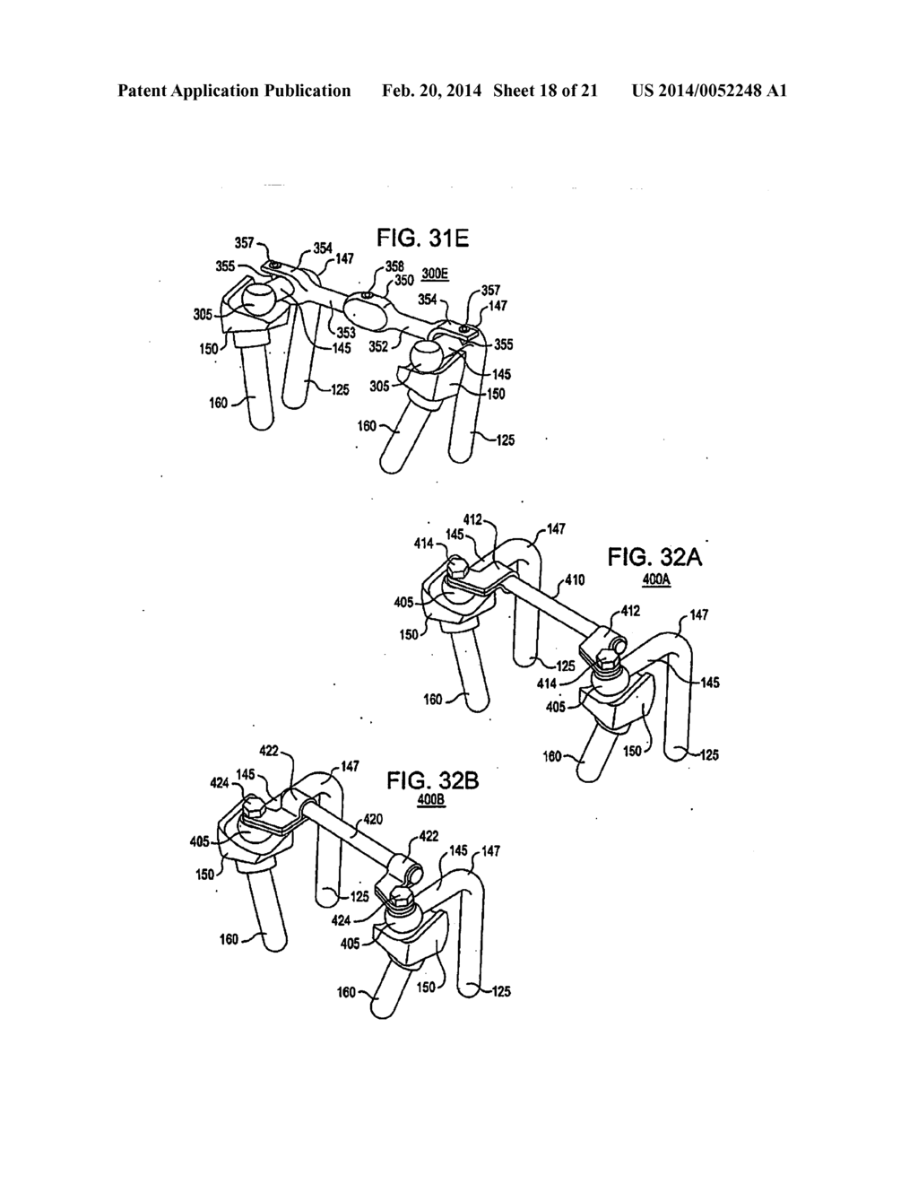 Crossbar Spinal Prosthesis Having a Modular Design and Related     Implantation Methods - diagram, schematic, and image 19