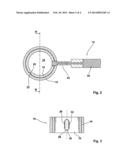 SPINAL IMPLANTS AND RELATED APPARATUS AND METHODS diagram and image