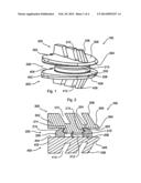 Spine Stabilization Device and Methods diagram and image