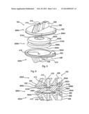 Spine Stabilization Device and Methods diagram and image