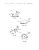 STAND ALONE INTERBODY FIXATION SYSTEM diagram and image