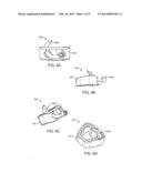 STAND ALONE INTERBODY FIXATION SYSTEM diagram and image