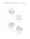 STAND ALONE INTERBODY FIXATION SYSTEM diagram and image