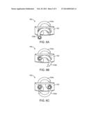 STAND ALONE INTERBODY FIXATION SYSTEM diagram and image