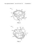 STAND ALONE INTERBODY FIXATION SYSTEM diagram and image