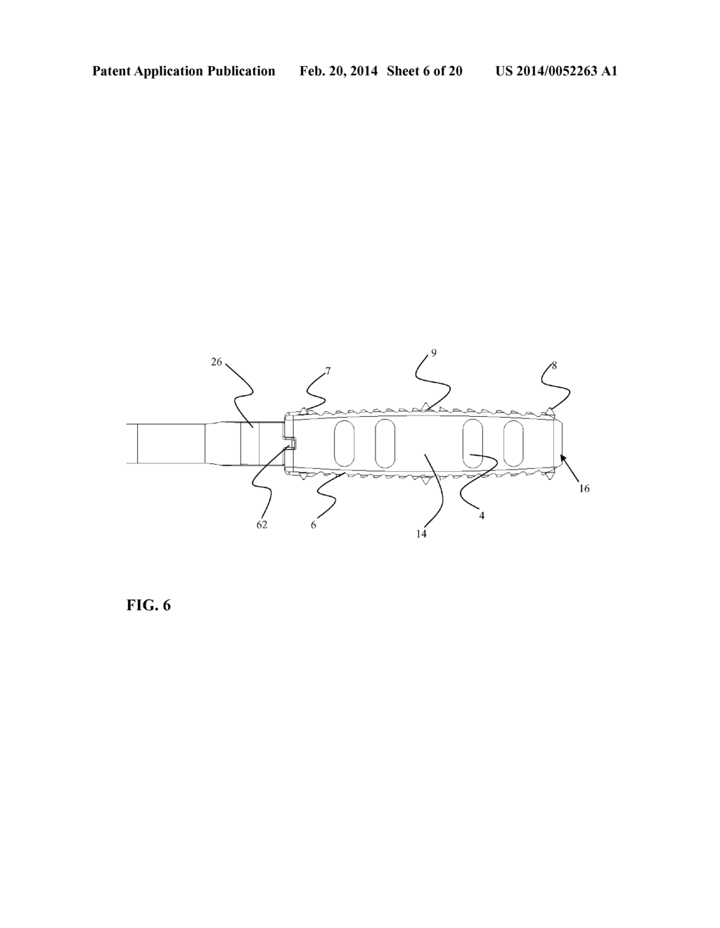 Systems and Methods for Spinal Fusion - diagram, schematic, and image 07