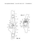 EXTRA-ARTICULAR IMPLANTABLE MECHANICAL ENERGY ABSORBING ASSEMBLIES HAVING     TWO DEFLECTING MEMBERS AND METHODS diagram and image