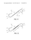 COMFORT STENTS diagram and image