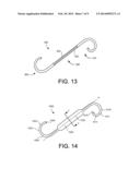 COMFORT STENTS diagram and image