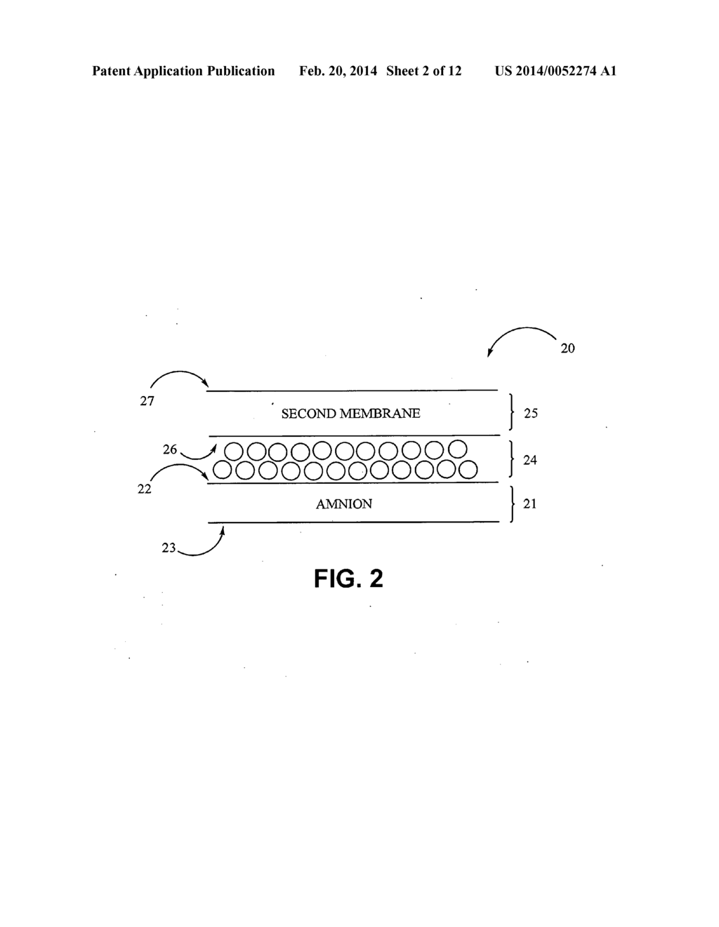 Tissue grafts composed of micronized placental tissue and methods of     making and using the same - diagram, schematic, and image 03