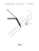 Wire Timing and Tensioning Device diagram and image