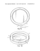 CONFIGURABLE INFLATABLE SUPPORT DEVICES diagram and image